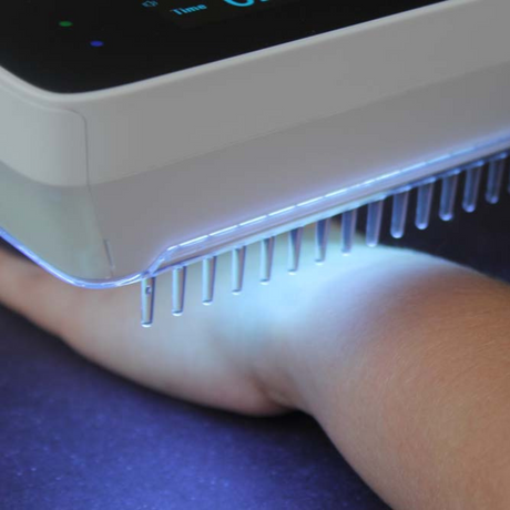 AureaPulse Handheld UVB Narrowband Phototherapy Lamp Timer And Touch Control - OpalDwell