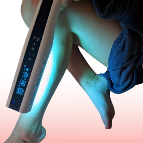 Lumara portable UVB phototherapy lamp 311nm device